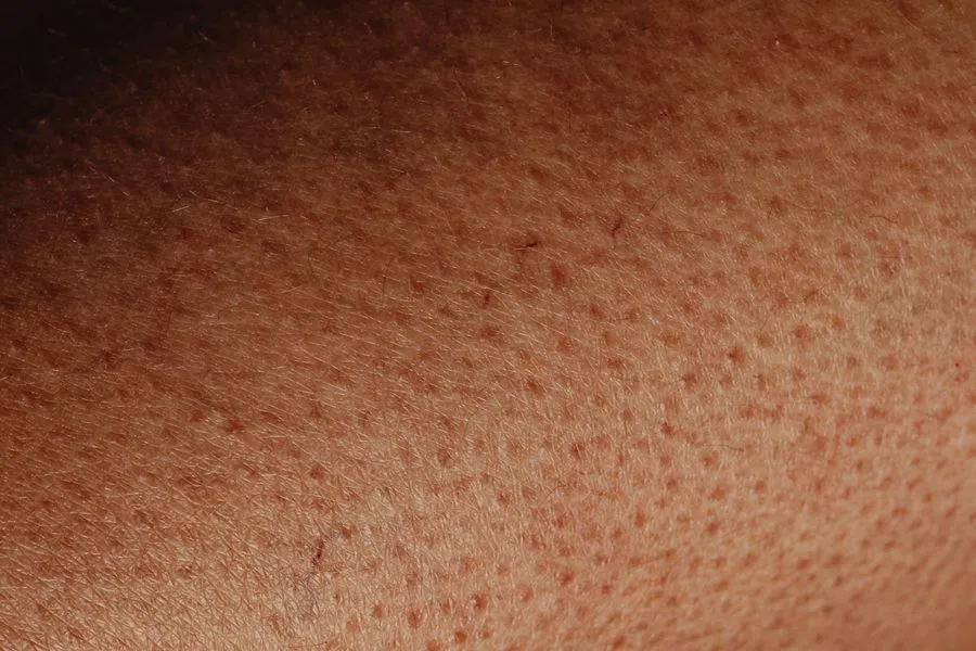 Pores